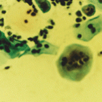 Πολυπύρηνο κύτταρο